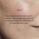 E.Q. Clear Skin Collection™