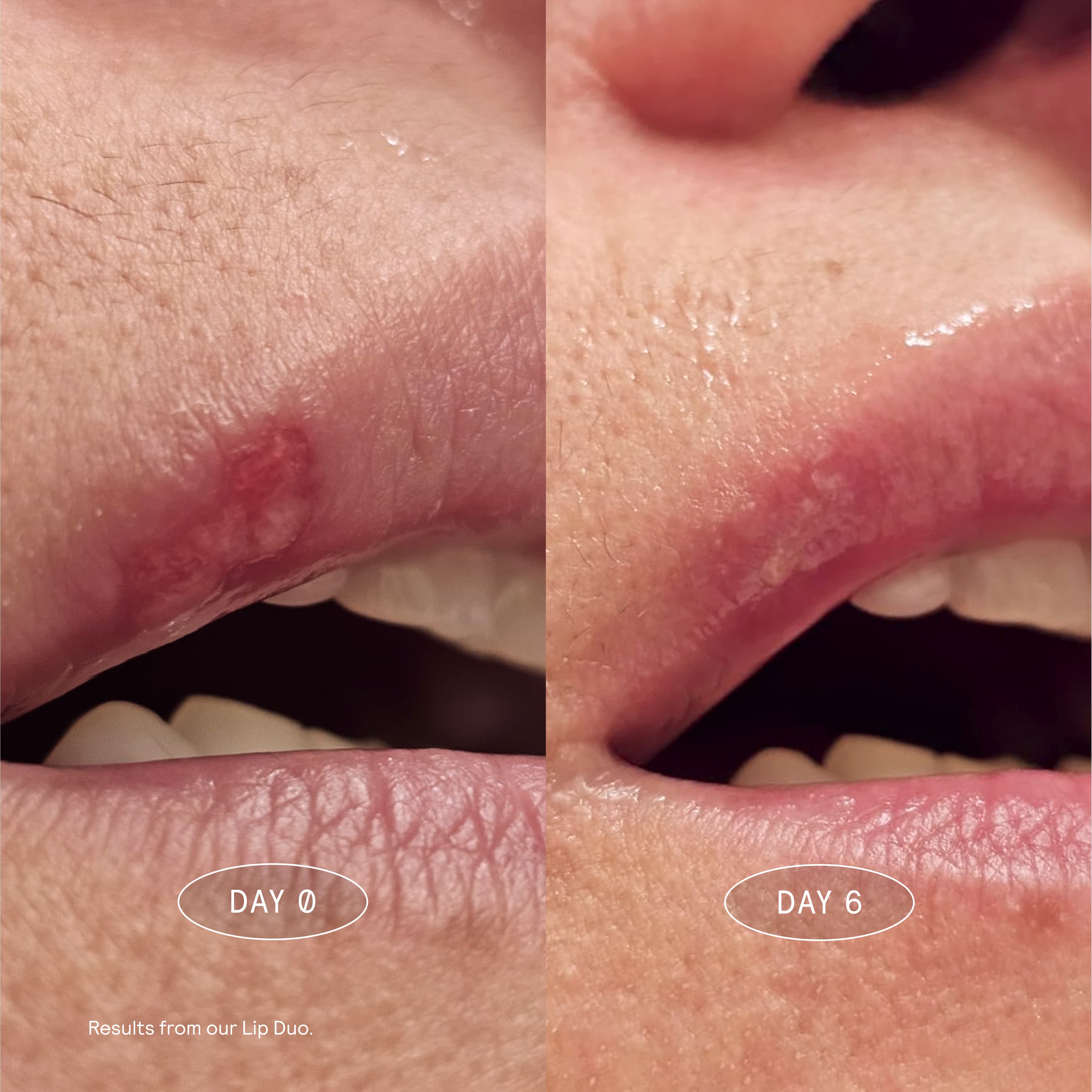 Lip Rescue Serum – MARK Los Angeles